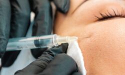 هوشمندانه‌ترین سرمایه‌گذاری روی صورت؛ فیلر گونه چطور جای کرم‌های گران‌قیمت را می‌گیرد؟