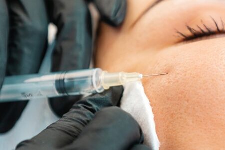 هوشمندانه‌ترین سرمایه‌گذاری روی صورت؛ فیلر گونه چطور جای کرم‌های گران‌قیمت را می‌گیرد؟